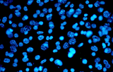 IGH probe for CISH CE/IVD - Non-Hodgkin lymphomas (NHL)