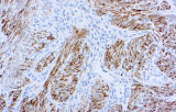 Anti-Desmin CE/IVD für die Immunhistochemie – Weichteilpathologie