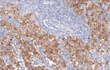 Anti-Podoplanin CE/IVD für die Immunhistochemie – Weichteilpathologie