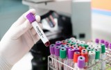 SARS-CoV-2 - Serologische Tests für Forschung und Entwicklung