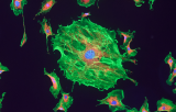 NTRK3 probe for ISH CE/IVD - Salivary gland cancers