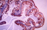 Detection kits for IHC