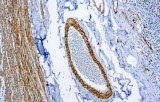 Smooth muscle myosin