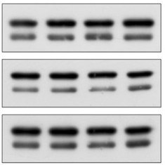 Custom service : Antibody validation in WB