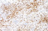 Anti-Annexin A1 CE/IVD for IHC - Hematopathology