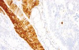 Anti-Arginase 1 CE/IVD for IHC - Gastrointestinal pathology