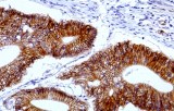 Anti-beta-catenin CE/IVD for IHC - Gastrointestinal pathology