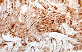 Anti-Caldesmon CE/IVD for IHC - Soft tissue pathology