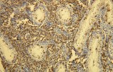 Anti-CD117 / c-kit CE/IVD for IHC - Gastrointestinal pathology