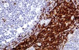 Anti-CD5 CE/IVD for IHC - Hematopathology