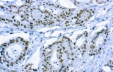 Anti-CD56 - NCAM CE/IVD for IHC - Hematopathology