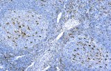 Anti-CD68 CE/IVD for IHC - Hematopathology