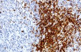 Anti-CD7 CE/IVD for IHC - Hematopathology