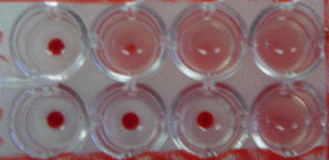 Complement fixation test (CFT) for mycology