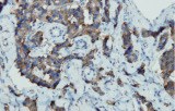 Anti-Chromogranin A CE/IVD for IHC - Gastrointestinal pathology