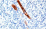 Factor VIII–related antigen
