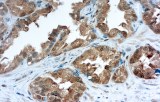 Anti-Galectin-3 CE/IVD for IHC - Head and neck pathology
