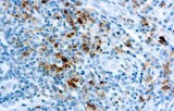 Anti-Granzyme B CE/IVD for IHC - Hematopathology