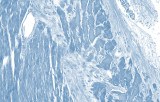 Classic immunohistochemistry (IHC)