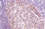 Anti-LMO2 CE/IVD for IHC - Hematopathology