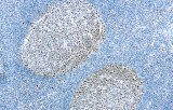 Anti-MSH2 CE/IVD for IHC - Gastrointestinal pathology