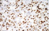 Anti-Myogenin CE/IVD for IHC - Soft tissue pathology