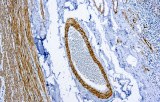 Smooth muscle myosin