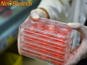 NeoBiotech FBS Solutions: Factors Influencing Performance