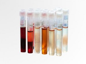 From Donor to Data: Your Human Sample Resource