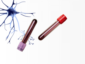 Human-Derived Samples for Neurological Investigations