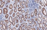 Anti-p504s CE/IVD for IHC - Genitourinary pathology