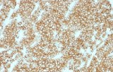 Anti-PTH CE/IVD for IHC - Head and neck pathology