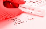 SARS-CoV-2 - Rapid tests ready-to-use for research and development