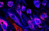 MYB probe for FISH CE/IVD - Acute lymphoblastic leukemia (ALL)