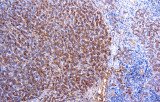 CE/IVD de anti-antitripsina para IHC - Hematopatología