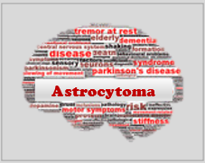 Astrocytoma