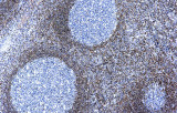 Anti-BCL-2 CE/IVD para IHC - Patología ginecológica