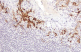 Anti-CD16 CE/IVD para IHC - Hematopatología