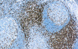 Anti-CD3 CE/IVD para IHC - Hematopatología