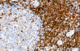 CE/IVD anti-CD4 para IHC - Hematopatología
