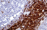 Anti-CD5 CE/IVD para IHC - Hematopatología