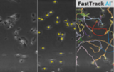 Análisis de imágenes Chemotaxis FastTrack AI