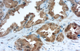 Galectina-3