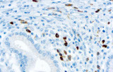 Anti-Lambda CE/IVD para IHC - Hematopatología