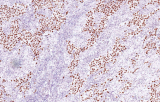 Anti-Nanog CE/IVD para IHC - Patología genitourinaria