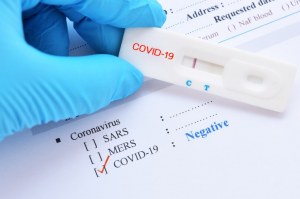 Sars Cov 2 Covid 19 Diagnosis By Igg Igm Rapid Test Clinisciences