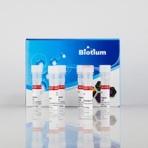 Cambie su visión de la PCR, pásese a la digital