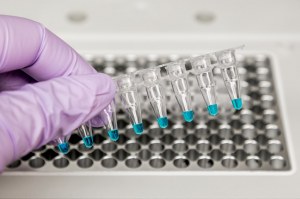 Nuevos kits ultrasensibles de detección de mutaciones genéticas por qPCR