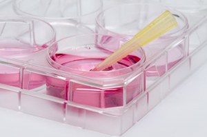 UltraGro: Potencie su cultivo de MSC 