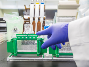 Protocolo de Western Blot